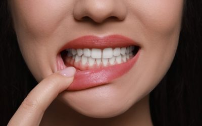 Best & Worst Foods for Gum Health