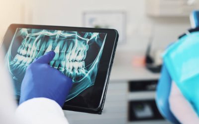 What’s New in Digital X-Ray Technology?
